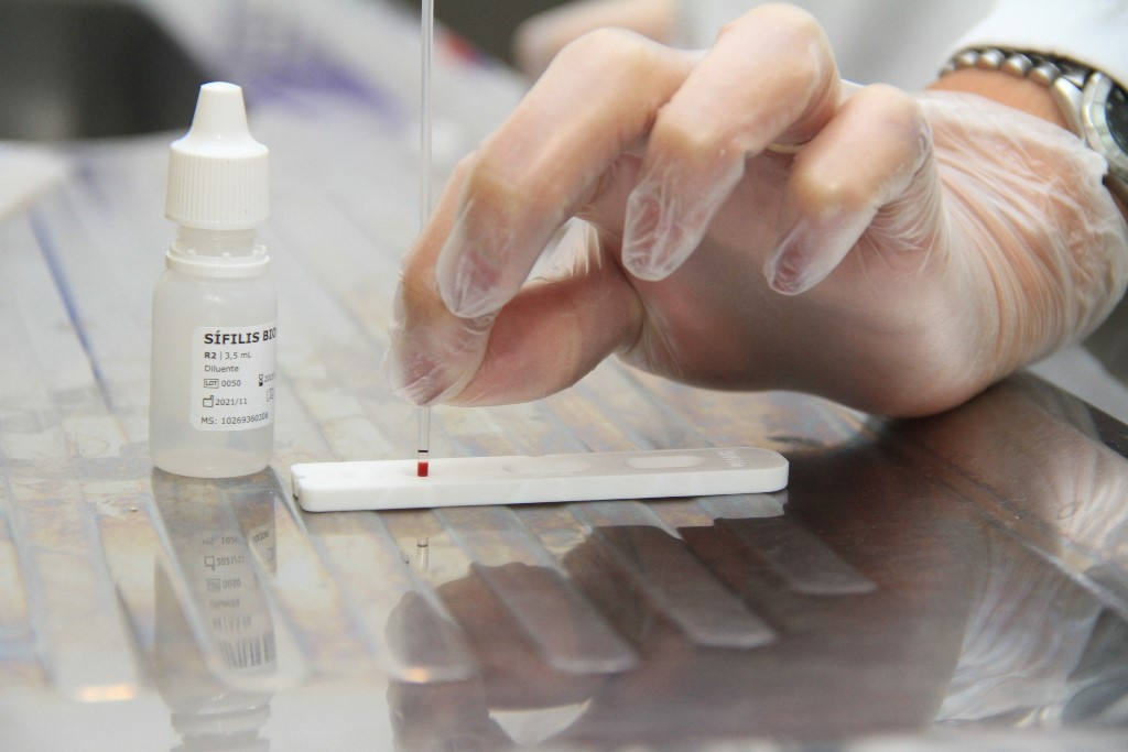 Saúde disponibiliza teste rápido de Sífilis para gestantes nas UBS
