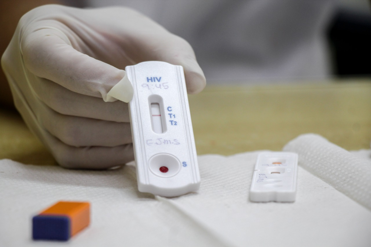 Saúde prepara Campanha Fique Sabendo com teste rápido HIV e Sífilis